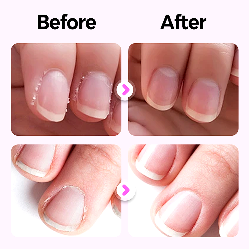 3-in-1 Nail Care Pen for Home & Travel